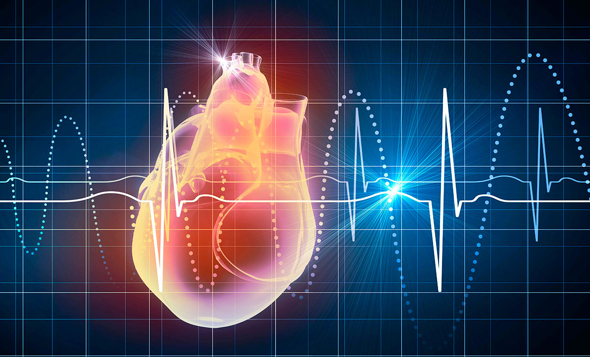 Electrocardiograma Dr Luis santillan